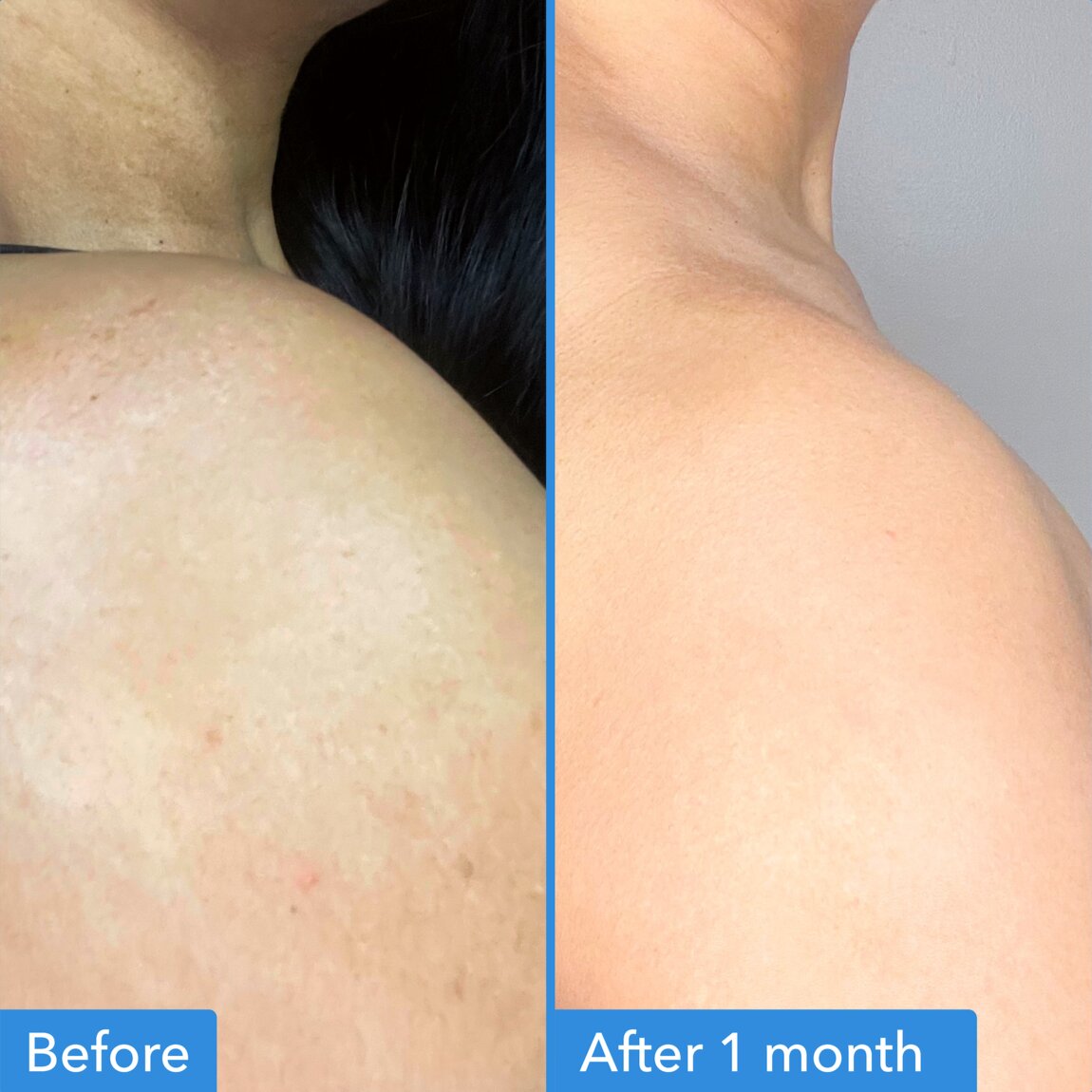 discoloration-correcting-body-treatment-h6 zb_p.jpg