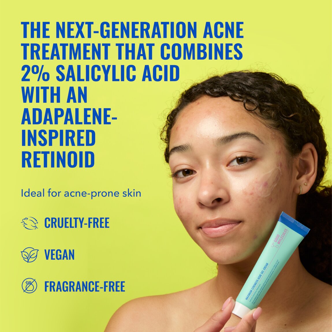 maximum-strength-acne-gel-cream-q0 zb_p.jpg