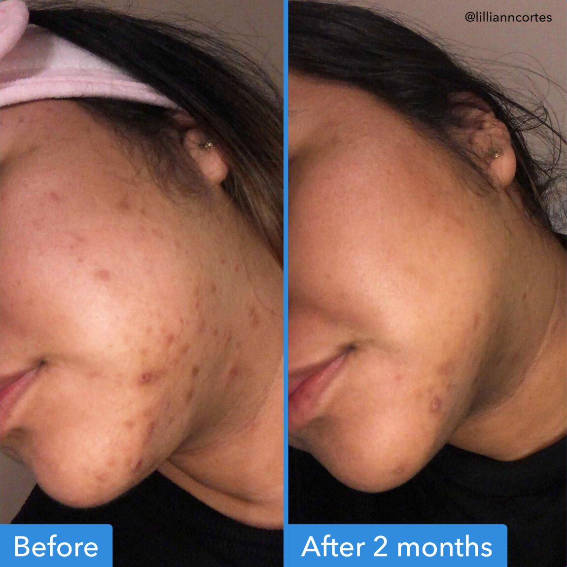 discoloration-correcting-serum-s8 zb_p.jpg